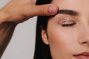 blépharoplastie à Lyon